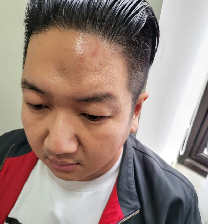 Gunakan Cara Preman, Pengusaha Agus Hartono Alami Penyiksaan Diduga Oleh Penyidik Kejati Jateng